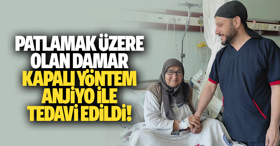 Patlamak üzere olan damar kapalı yöntem anjiyo ile tedavi edildi!