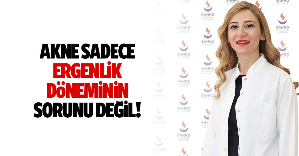 Akne sadece ergenlik döneminin sorunu değil!