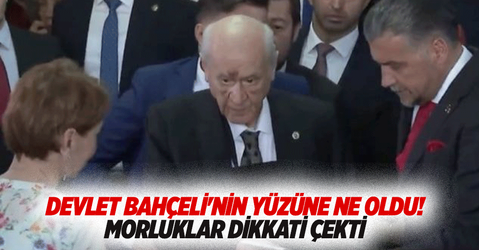 Devlet Bahçeli'nin yüzüne ne oldu! Morluklar dikkati çekti