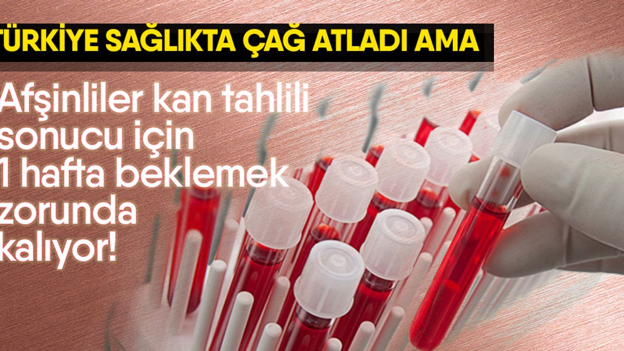 Afşinliler Kan Tahlili Sonucu için 1 Hafta Beklemek zorunda kalıyor!
