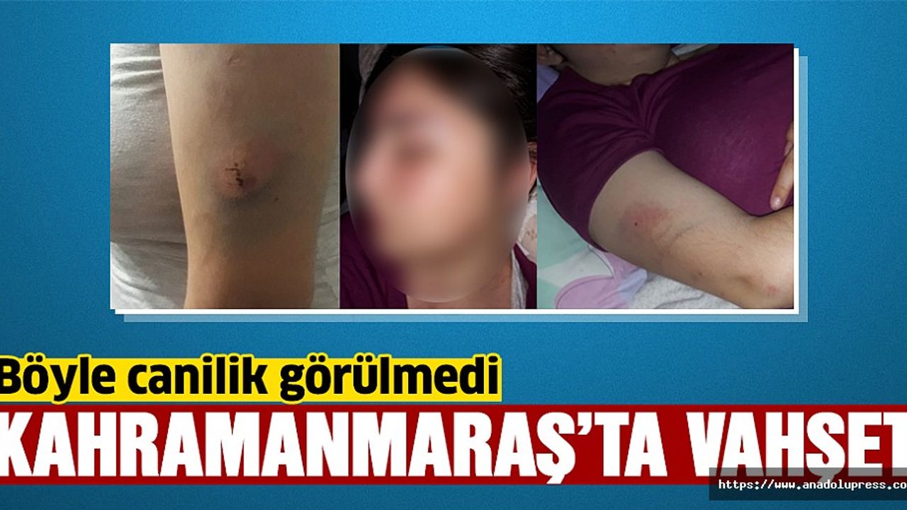 Kamanmaraş'ta darp iddiası