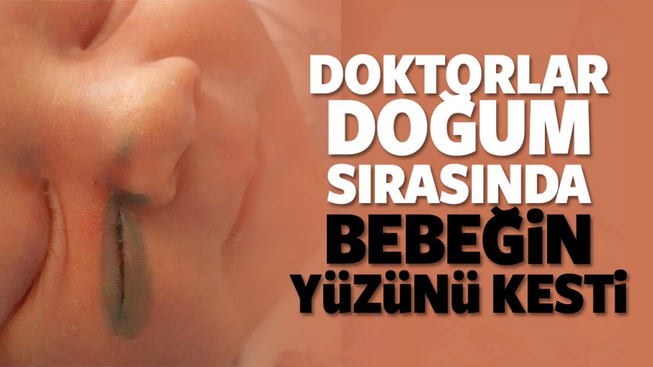 Doktorlar doğum sırasında bebeğin yüzünü kesti