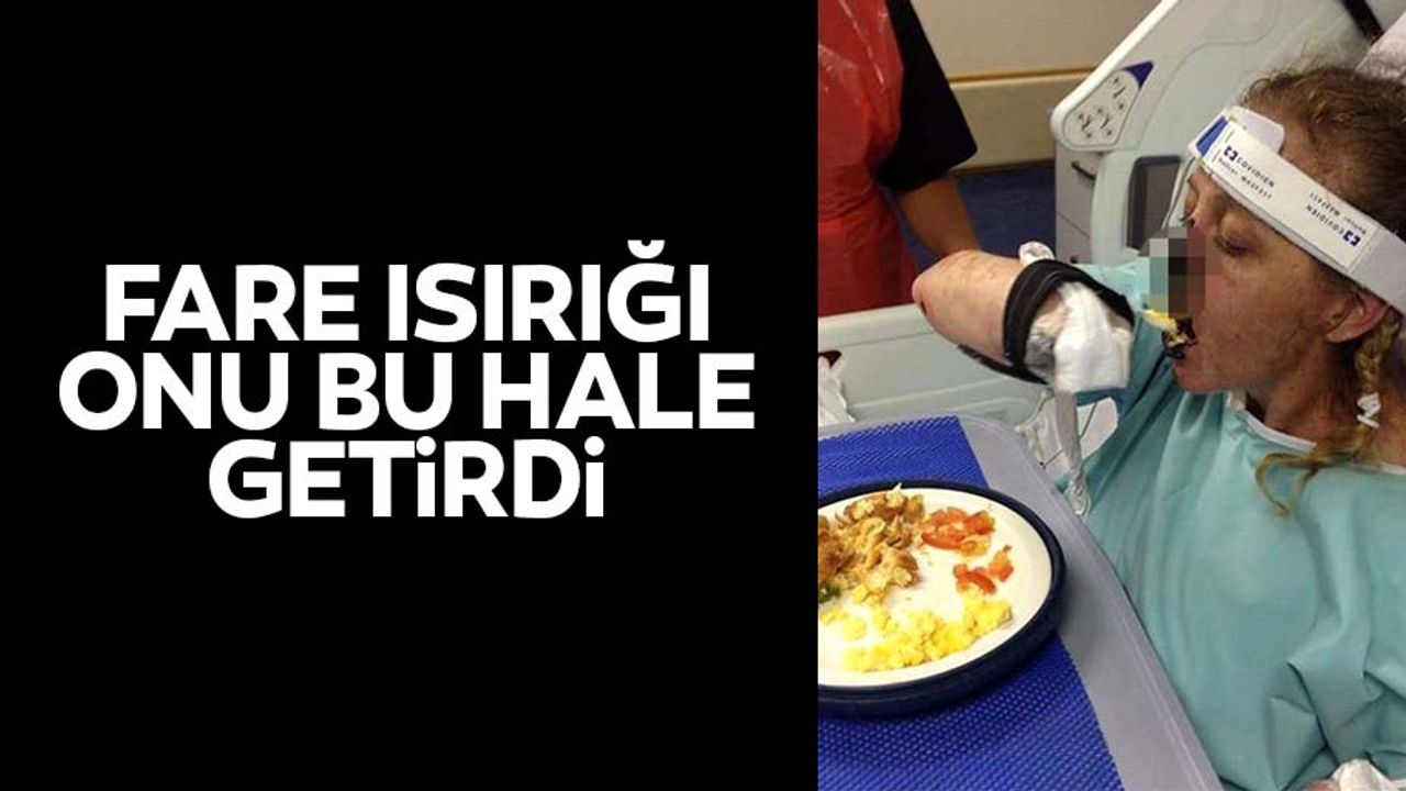 Fare ısırığı onu bu hale getirdi