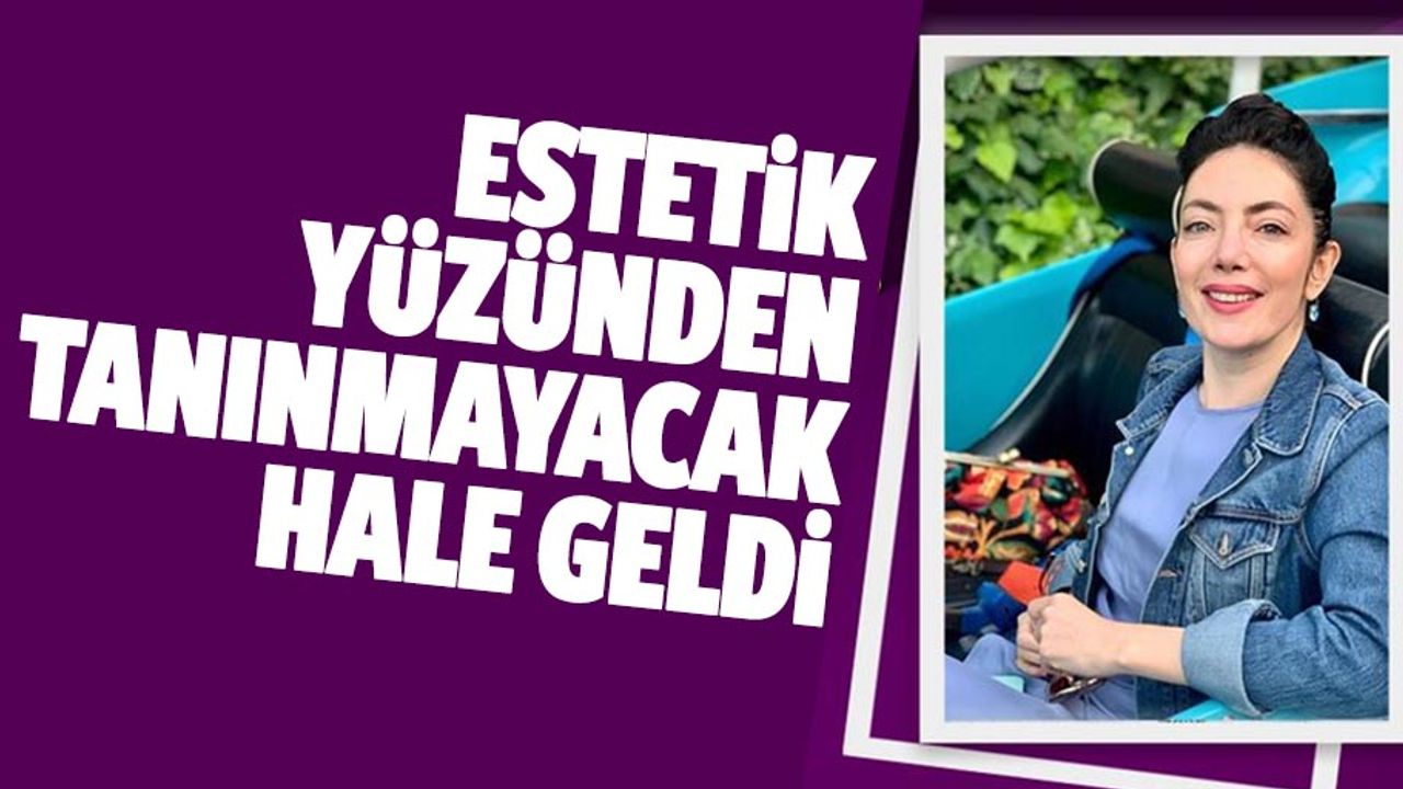 Oyuncu Akasya Asıltürkmen tanınmayacak hale geldi!
