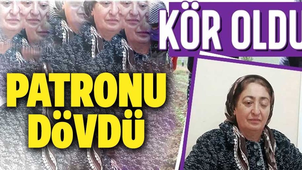 Patronu tarafından dövülen kadın işçi, tek gözünü kaybetti