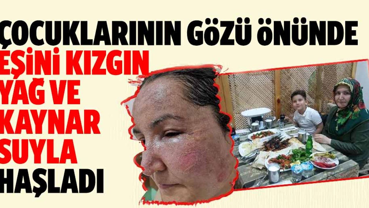 Çocuklarının Gözü Önünde Eşini Kızgın Yağ Ve Kaynar Suyla Haşladı