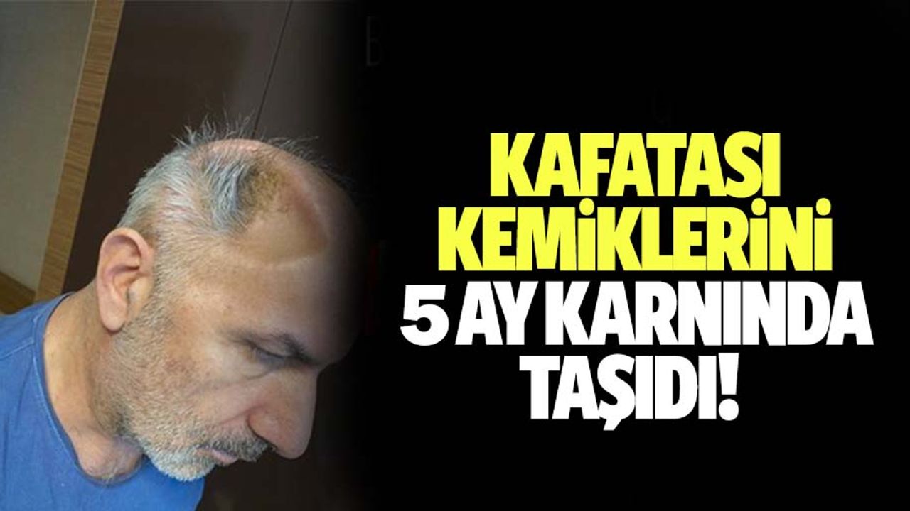 Kafatası kemiklerini 5 ay karnında taşıdı!