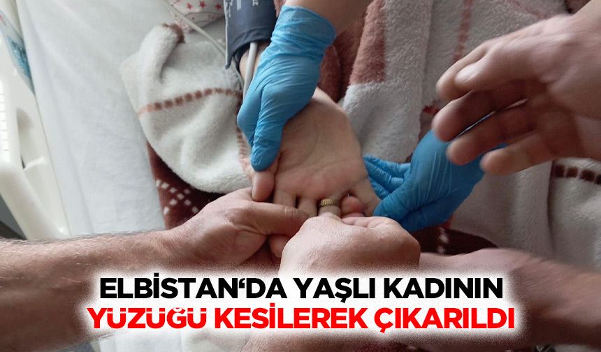 Elbistan‘da Yaşlı Kadının Yüzüğü Kesilerek Çıkarıldı!